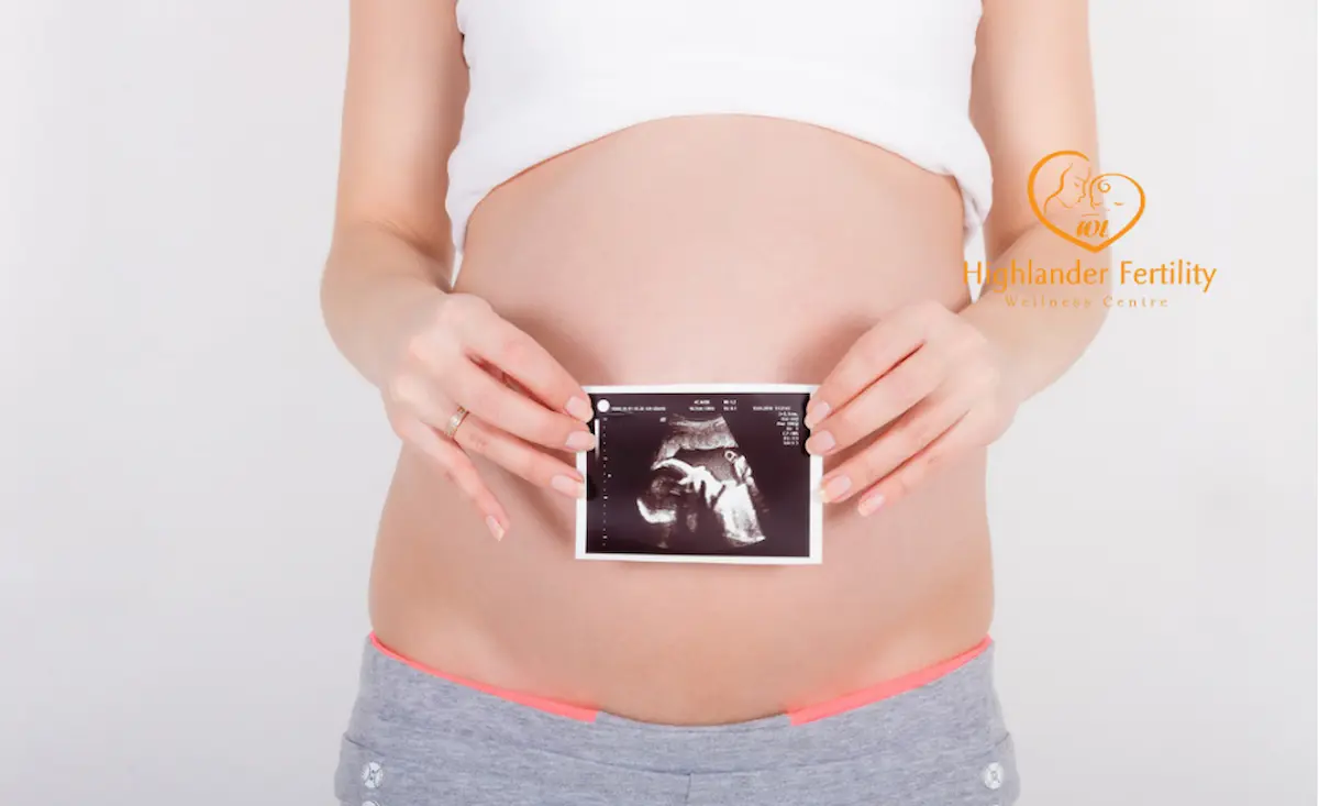 Pregnant woman holding an ultrasound image, illustrating how irregular menses and pregnancy can sometimes be linked through missed or delayed menstrual cycles.